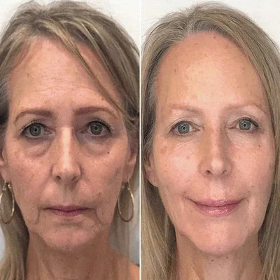 ClearGleam Vitamin B5 Serum – Your Fast-Track to Radiant, Hydrated Skin - 1+1 FREE