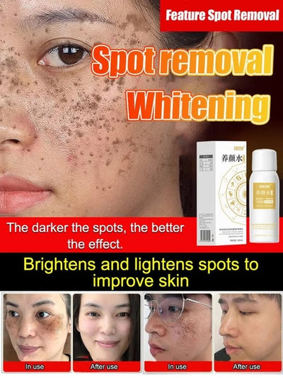 The Clarity Elixir - Erase All Spots, Reveal Radiance - 50% OFF
