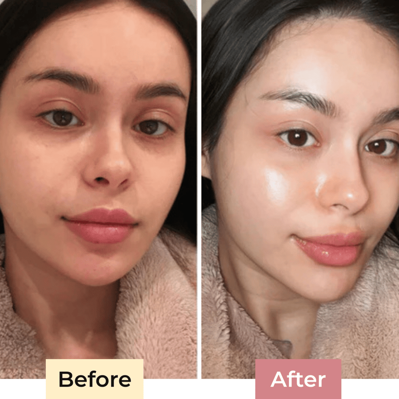 The SolaraShield - Protect Your Skin, Perfect Your Makeup - 50% OFF