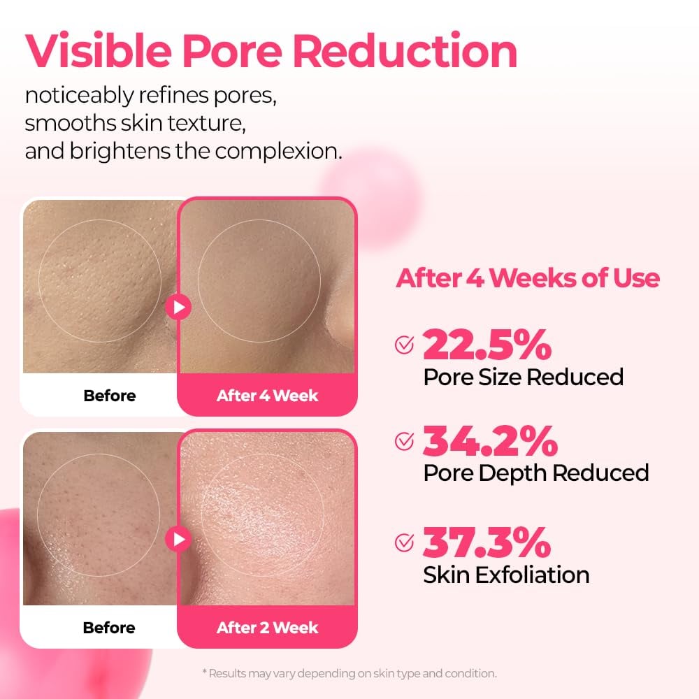 DermaPhase System - Resurface Your Skin, Erase Imperfections - 50% OFF