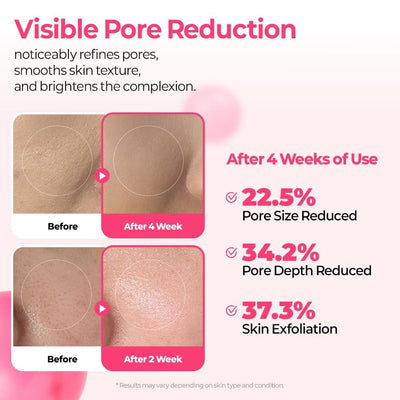 DermaPhase System - Resurface Your Skin, Erase Imperfections - 50% OFF