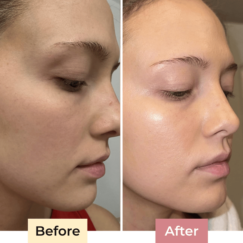 The SolaraShield - Protect Your Skin, Perfect Your Makeup - 50% OFF