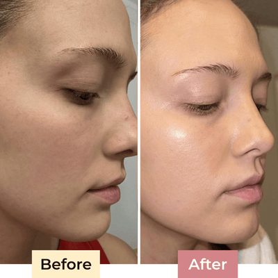 The SolaraShield - Protect Your Skin, Perfect Your Makeup - 50% OFF