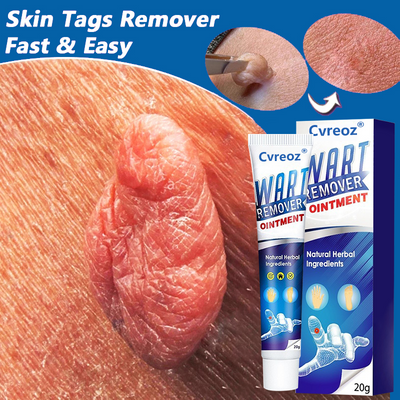 DermaClear Wart Ointment - Your Permanent Skin Solution - 50% OFF