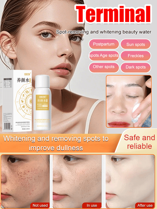 The Clarity Elixir - Erase All Spots, Reveal Radiance - 50% OFF