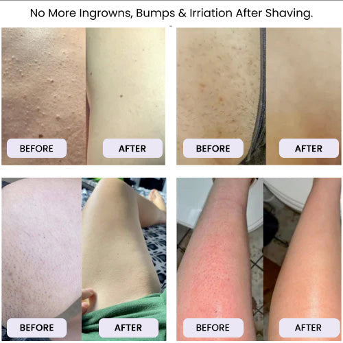 The Smooth Shave Razor - Silky Smooth Skin, Guaranteed. + 50% OFF