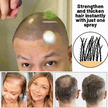 FolliVive - When I Got My Hair Back, I Got Me Back - 50% OFF