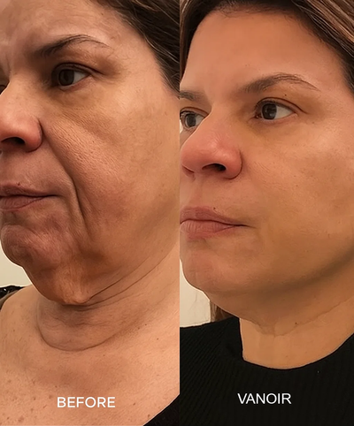 ChronoStamp - Unlock Your Skin's Full Potential - 50% OFF