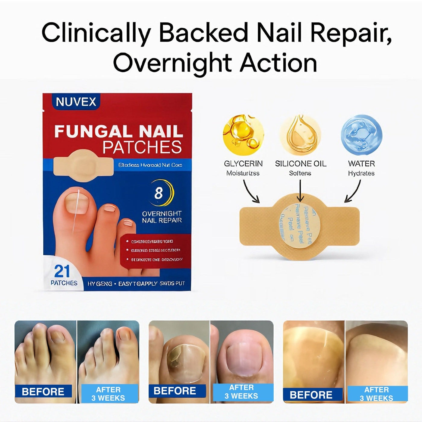 KeraClear Patch - Restore Clear, Healthy Nails - 50% OFF