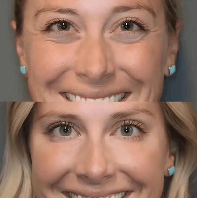 The InstaLift Film - Look Years Younger, Instantly - 50% OFF