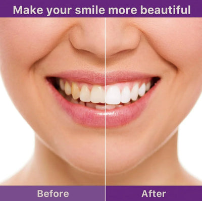 The Natural White Powder - Whiten Without the Pain + 50% OFF