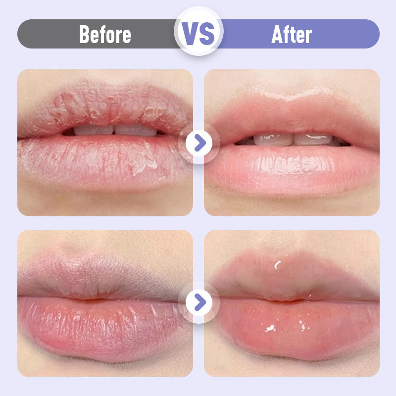 The LipMatrix Elixir - The End of Lined, Thin Lips - 50% OFF