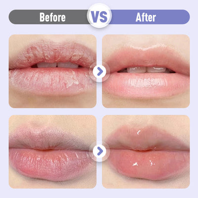 The LipMatrix Elixir - The End of Lined, Thin Lips - 50% OFF