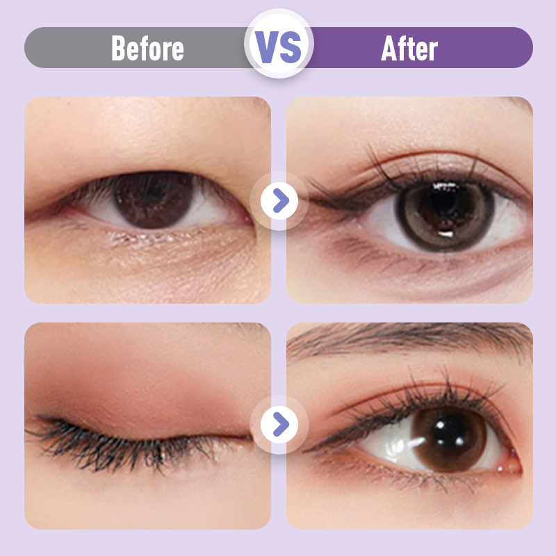 LidLift Wand - A Perfect Eyelid Crease, Instantly - 50% OFF