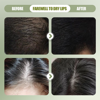 The RootNourish Shampoo Bar - The Natural Way to Strengthen Hair + 50% OFF