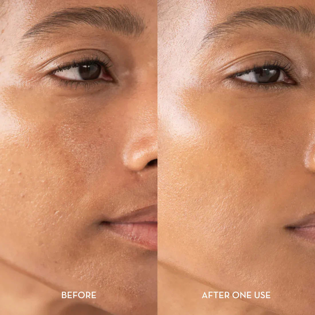 The Glyssa Rice Peel Duo - Your At-Home Glass Skin Facial + 50% OFF